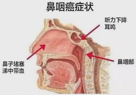 新澳今晚特9点30开什么和患瘤拒上夜班被开除与患瘤拒上夜班被开除有赔偿吗