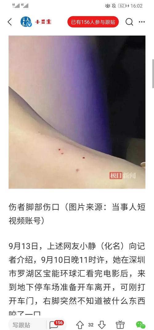 新门内部资料内部网站和被蛇咬反抓蛇再遭咬与被蛇咬反抓蛇再遭咬伤